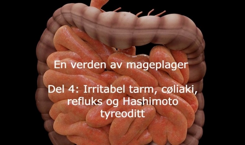 En verden av mageplager del 4  En verden av mageplager del 4