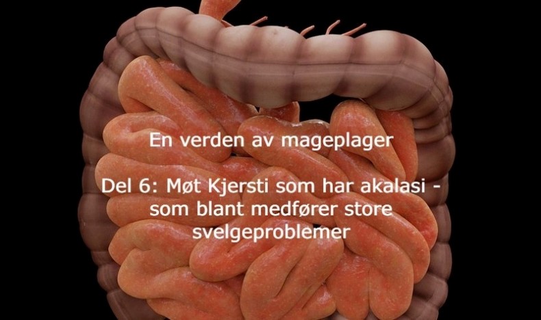 En verden av mageplager del 6 En verden av mageplager del 6